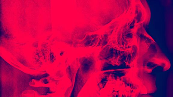 Dresscode - Under the Surface