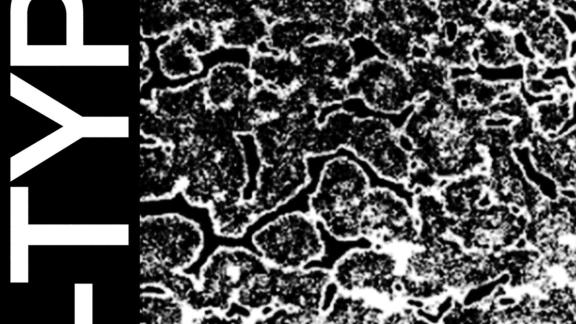 Joyeux jeudi : HEALTH sort un EP de remixes