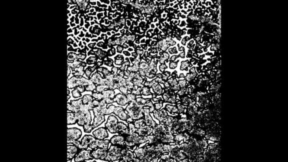 HEALTH sort l'EP ADDENDUM